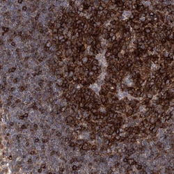FAM167A Antibody, Novus Biologicals 0.1mL; Unlabeled:Antibodies, Polyclonal