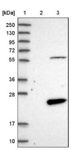 FAM167B Antibody, Novus Biologicals 0.1mL; Unlabeled:Antibodies, Polyclonal