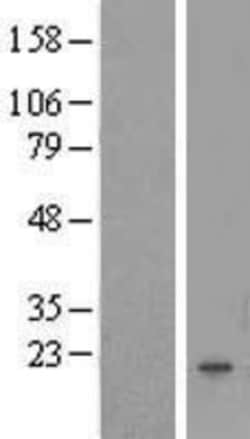 Novus Biologicals&trade;&nbsp;FAM167B Overexpression Lysate