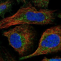 FAM167B Antibody, Novus Biologicals 0.1mL; Unlabeled:Antibodies, Polyclonal
