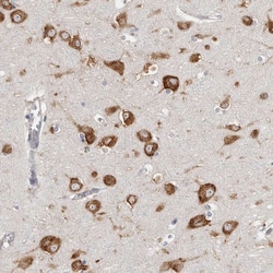 FAM167B Antibody, Novus Biologicals 0.1mL; Unlabeled:Antibodies, Polyclonal