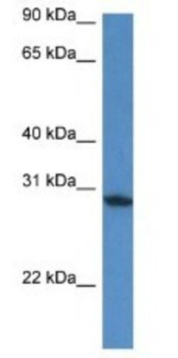 FAM168A Antibody, Novus Biologicals 100&mu;L; Unlabeled:Antibodies, Polyclonal