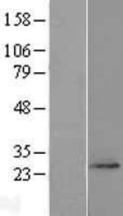 Novus Biologicals&trade;&nbsp;FAM168A Overexpression Lysate