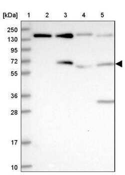 FAM169A Antibody, Novus Biologicals 25 &mu;L, Unlabeled:Antibodies, Polyclonal