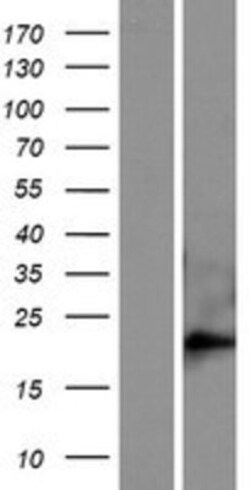 Novus Biologicals&trade;&nbsp;FAM169B Overexpression Lysate