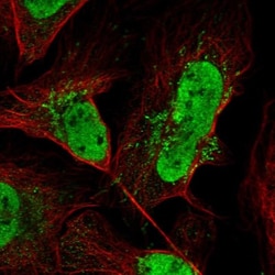 FAM170b Antibody, Novus Biologicals 0.1mL; Unlabeled:Antibodies, Polyclonal