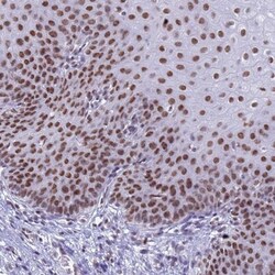 FAM170b Antibody, Novus Biologicals 0.1mL; Unlabeled:Antibodies, Polyclonal