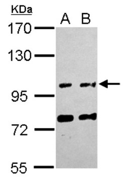 FAM171A1 Antibody, Novus Biologicals 0.1 mL | Buy Online | Novus Biologicals | Fisher Scientific