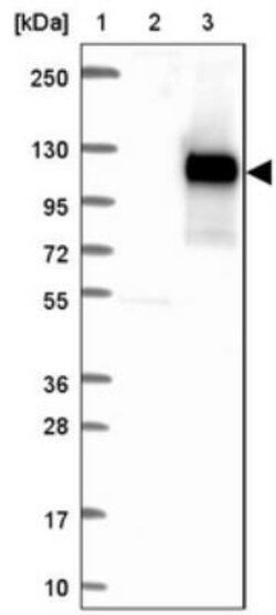 FAM171B Antibody, Novus Biologicals 0.1mL; Unlabeled:Antibodies, Polyclonal