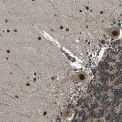 INPP1 Antibody, Novus Biologicals:Antibodies:Primary Antibodies