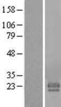 Novus Biologicals&trade;&nbsp;FAM174A Overexpression Lysate