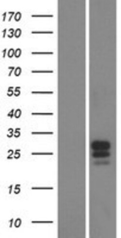 Novus Biologicals&trade;&nbsp;FAM174B Overexpression Lysate