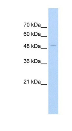 FAM174B Antibody, Novus Biologicals:Antibodies:Primary Antibodies