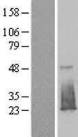 Novus Biologicals&trade;&nbsp;FAM176B Overexpression Lysate