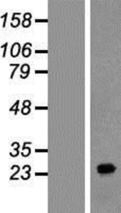 Novus Biologicals&trade;&nbsp;FAM177A1 Overexpression Lysate
