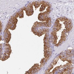 FAM177A1 Antibody, Novus Biologicals 25 &mu;L, Unlabeled:Antibodies, Polyclonal