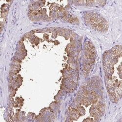 FAM177B Antibody, Novus Biologicals 0.1mL; Unlabeled:Antibodies, Polyclonal