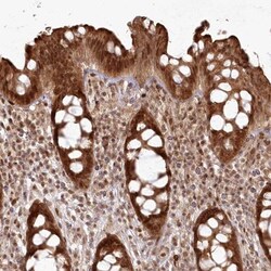 FAM179A Antibody, Novus Biologicals 25 &mu;L, Unlabeled:Antibodies, Polyclonal