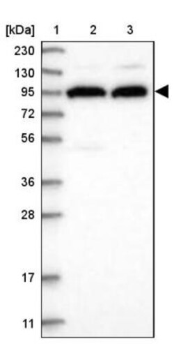 FAM179A Antibody, Novus Biologicals 25 &mu;L, Unlabeled:Antibodies, Polyclonal