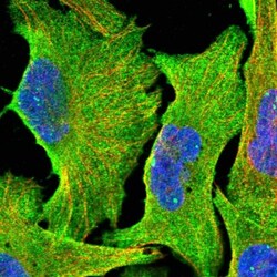 FAM180B Antibody, Novus Biologicals 25 &mu;L | Buy Online | Novus Biologicals | Fisher Scientific