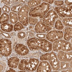 FAM180B Antibody, Novus Biologicals 25 &mu;L | Buy Online | Novus Biologicals | Fisher Scientific