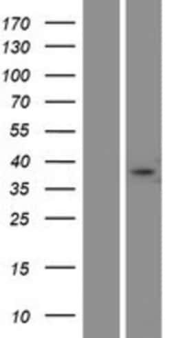 Novus Biologicals™ FAM181A Overexpression Lysate