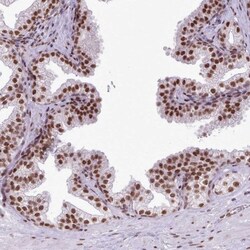 FAM182B Antibody, Novus Biologicals 25 μL, Unlabeled:Antibodies, Polyclonal