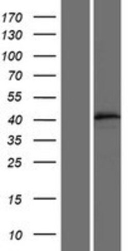 Novus Biologicals&trade;&nbsp;FAM185A Overexpression Lysate