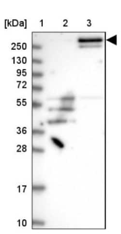 FAM186A Antibody, Novus Biologicals 25 &mu;L | Buy Online | Novus Biologicals | Fisher Scientific