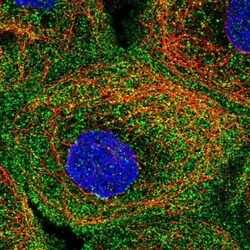 FAM186A Antibody, Novus Biologicals 25 &mu;L | Buy Online | Novus Biologicals | Fisher Scientific