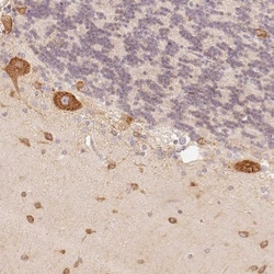 FAM189A2 Antibody, Novus Biologicals 25 &mu;L, Unlabeled:Antibodies, Polyclonal