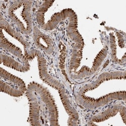 MAP3K12 binding inhibitory protein 1 Antibody, Novus Biologicals:Antibodies:Primary