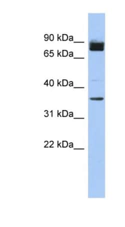FAM190A Antibody, Novus Biologicals 100&mu;L; Unlabeled:Antibodies, Polyclonal