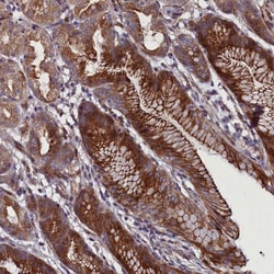 FAM195B Antibody, Novus Biologicals 0.1mL; Unlabeled:Antibodies, Polyclonal