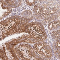 FAM196B Antibody, Novus Biologicals:Antibodies:Primary Antibodies