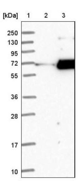 ACOX3 Antibody, Novus Biologicals:Antibodies:Primary Antibodies