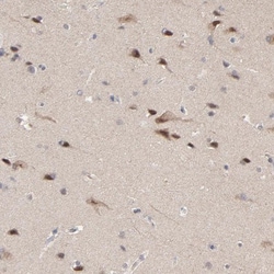FAM199X Antibody, Novus Biologicals 0.1mL; Unlabeled:Antibodies, Polyclonal