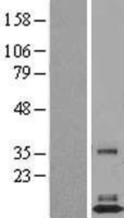 Novus Biologicals&trade;&nbsp;TAFA3/FAM19A3 Overexpression Lysate