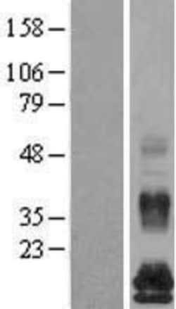 Novus Biologicals&trade;&nbsp;TAFA5/FAM19A5 Overexpression Lysate