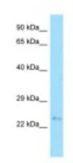 FAM207A Antibody, Novus Biologicals 100&mu;L; Unlabeled:Antibodies, Polyclonal