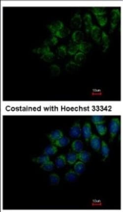 FAM20C Antibody, Novus Biologicals 0.1mL; Unlabeled:Antibodies, Polyclonal