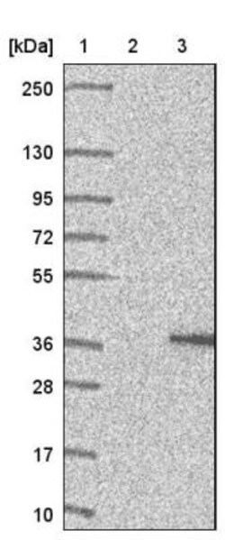 FAM210A Antibody, Novus Biologicals 0.1mL; Unlabeled:Antibodies, Polyclonal