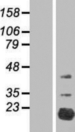 Novus Biologicals&trade;&nbsp;FAM210A Overexpression Lysate