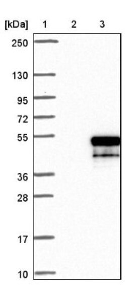 HLA DMB Antibody, Novus Biologicals:Antibodies:Primary Antibodies