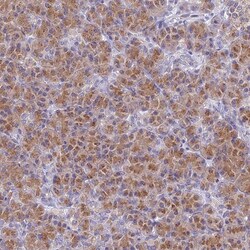 HLA DMB Antibody, Novus Biologicals:Antibodies:Primary Antibodies