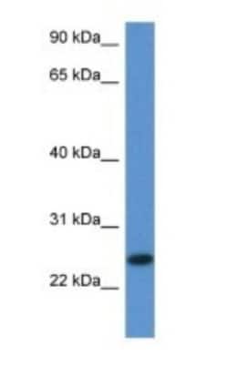FAM213B Antibody, Novus Biologicals 100&mu;L; Unlabeled:Antibodies, Polyclonal