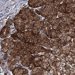 FAM214A Antibody, Novus Biologicals 0.1mL; Unlabeled:Antibodies, Polyclonal