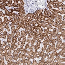FAM214B Antibody, Novus Biologicals 25 &mu;L, Unlabeled:Antibodies, Polyclonal