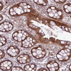 FAM222B Antibody, Novus Biologicals 0.1mL; Unlabeled:Antibodies, Polyclonal