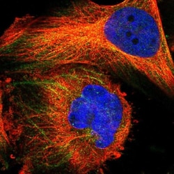 FAM26E Antibody, Novus Biologicals 0.1mL; Unlabeled:Antibodies, Polyclonal